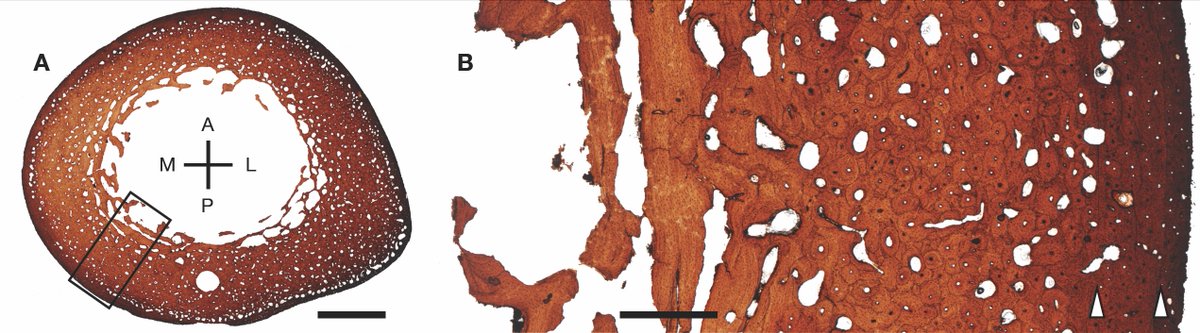 We were even able to estimate the age of the two sabrekittens (sabrecubs?) using what we knew about their tooth eruption and some histology work I did for a book chapter published in 2018.Turns out, they were probably about two years old.