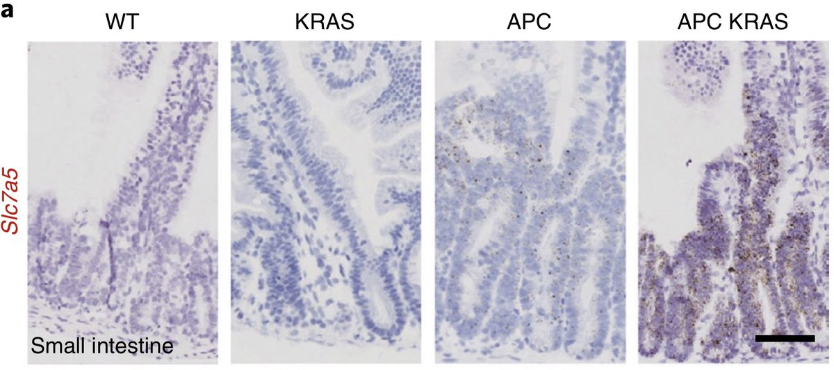 When we stained for  #Slc7a5 we found it selectively upregulated on both mRNA and protein levels in  #Apc deficient  #Kras mutant tissues and tumours.
