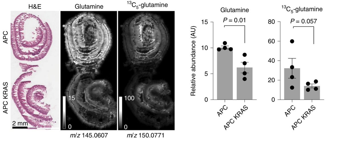 This is where the  #Rosetta  #GrandChallenge Team  @CancerGrand were crucial – together w/ them we established a mass spectrometry  #imaging  #msi platform to look at metabolites in situ. This confirmed lack of glutamine in Kras mutant tissues. Importantly this wasn’t due to  usage