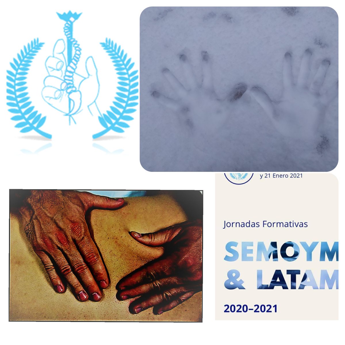 SEMOOYM_OFICIAL's tweet photo. Gracias por difundír

Curso online de #medicinamanual para médicos. 

Para toda España y toda Latinoamérica!!! 

👇👇👇👇

https://t.co/3BZWFv1VhK

✔ acreditado
✔enero y febrero

@samfyr @AJSM_SportsMed @ejprm @Soc_Mex_Rehab @SEReumatologia https://t.co/YDBTL9qTOR