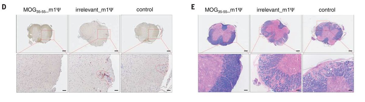 ScienceMagazine's tweet photo. Researchers have designed an #mRNA vaccine that delayed the onset of and reduced the severity of multiple sclerosis-like disease in mice. 

The vaccine restores the body’s tolerance to its own proteins, suppressing the disease's immune overreactivity. ($) https://t.co/GrCkl6UNh0 https://t.co/7KNlJ2oZrx