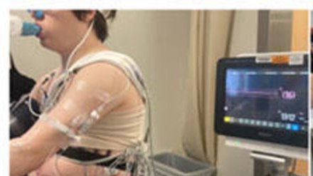 At  @CincyKidsHeart we have been doing cardiopulmonary exercise tests (CPET) with PVP monitoring and recently published our findings in  @Heart_BMJ.  http://dx.doi.org/10.1136/heartjnl-2020-317179