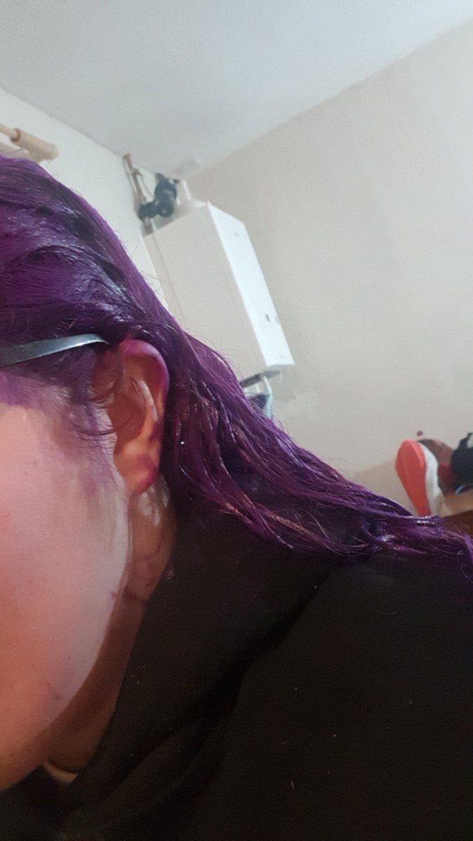 KellyDean_95's tweet photo. @bradmondonyc How convenient im currently dying my hair this colour using henna colouring 🙈 https://t.co/juLtgTnyJx