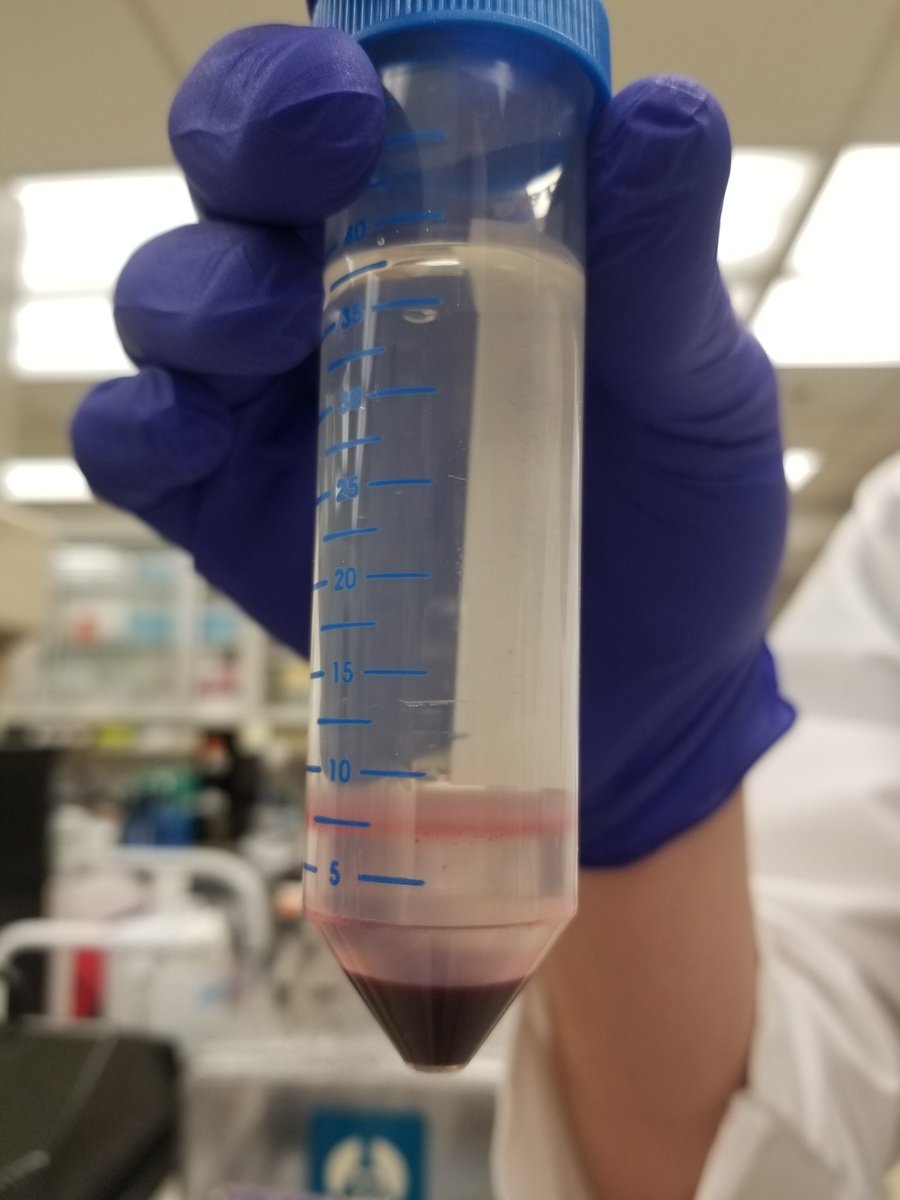 robinsonlab_WVU's tweet photo. When your #Ficoll gradient turns out wicked nice 🤩🤩🤩 #cordblood #mononuclearcells #densitygradient https://t.co/x6ohEhvfuP