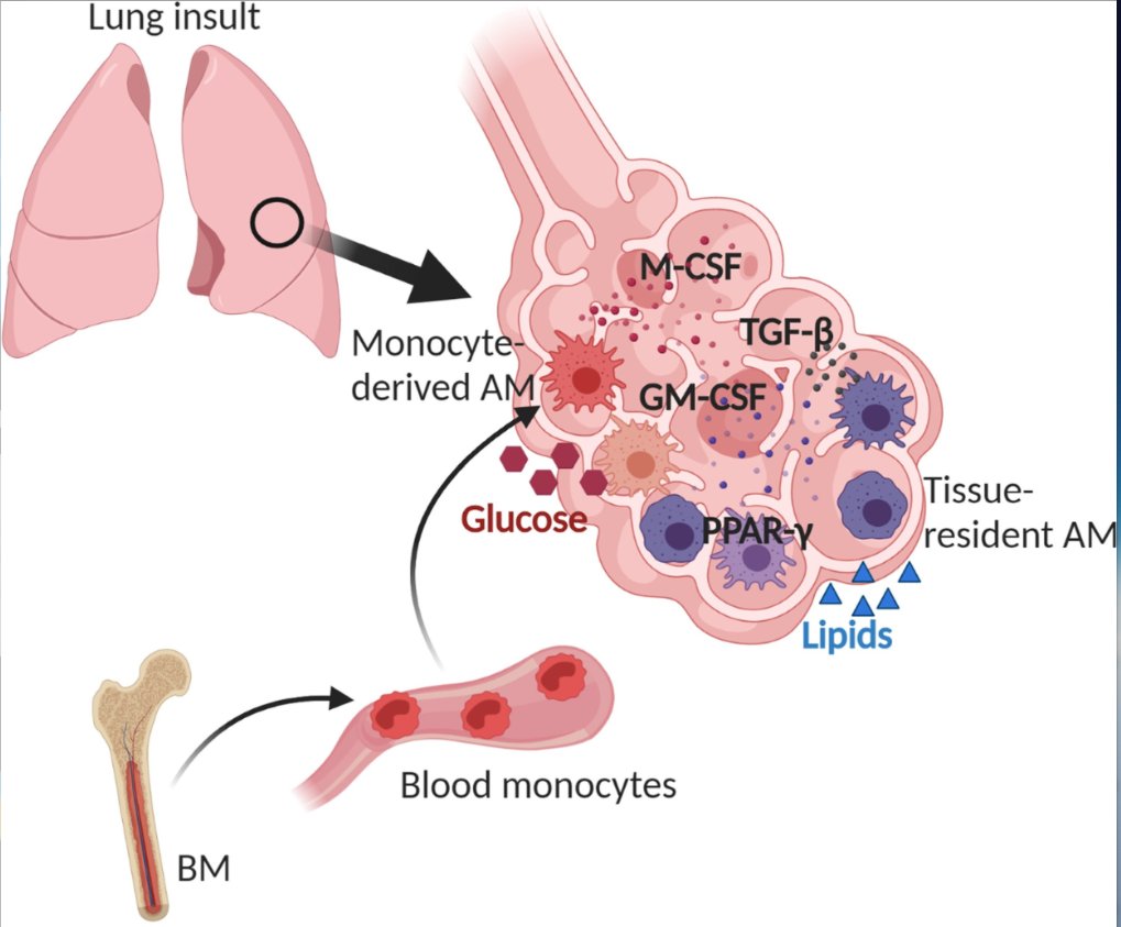 mmw_lmw's tweet photo. The Plasticity of #Lung #Alveolar_Macrophage Subsets | Signals that shape Newly Recruited AM | Andreas Wack @TheCrick @TrendsImmuno https://t.co/49aZm2ZYJb | #2020_ReCapSept https://t.co/M9cr0undFy
