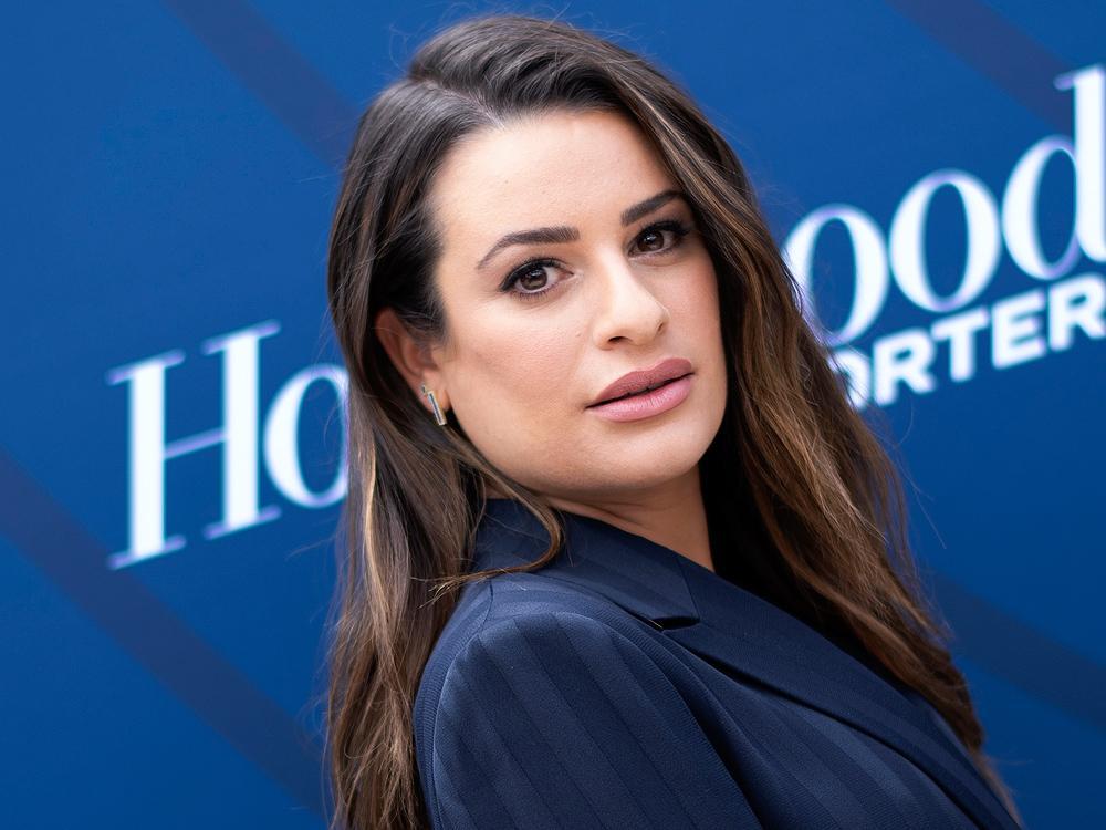 Lea Michele suffering from postpartum hair loss