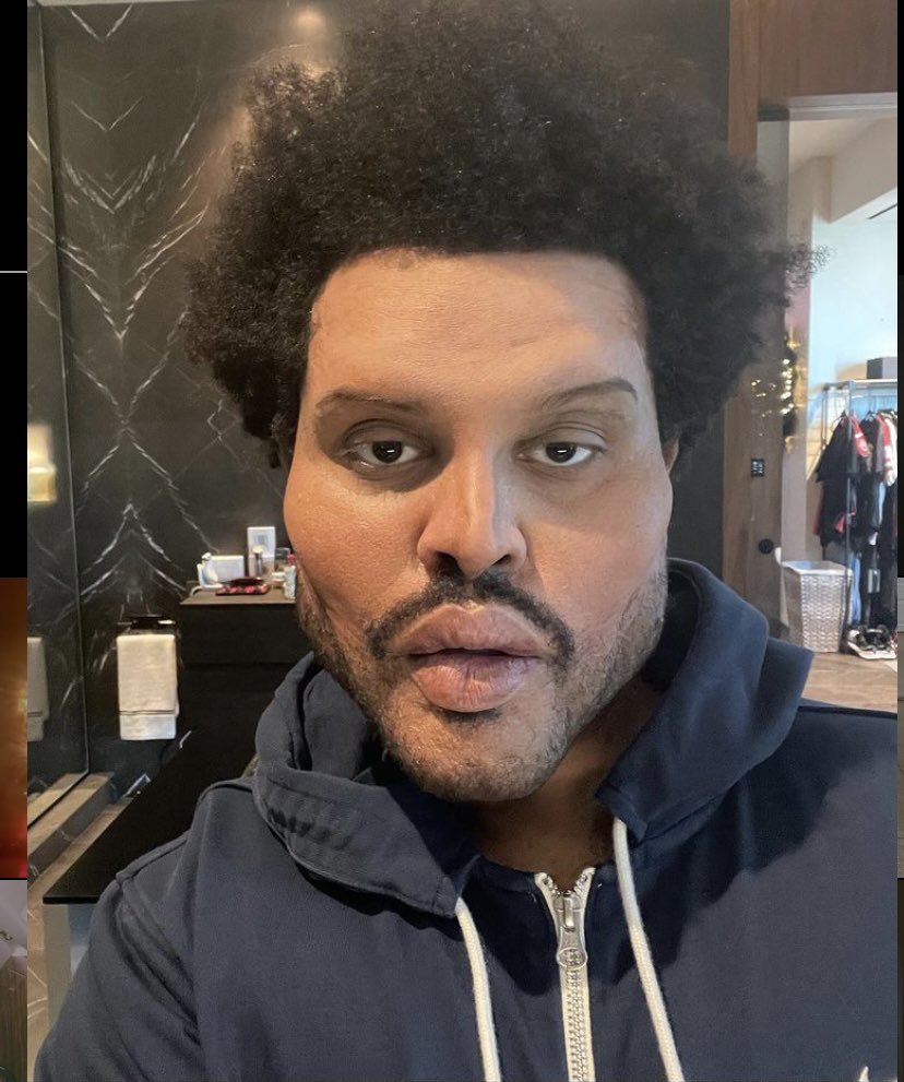 els_925's tweet photo. i didn’t know the weeknd had a nut allergy https://t.co/HBDRYcIHX6