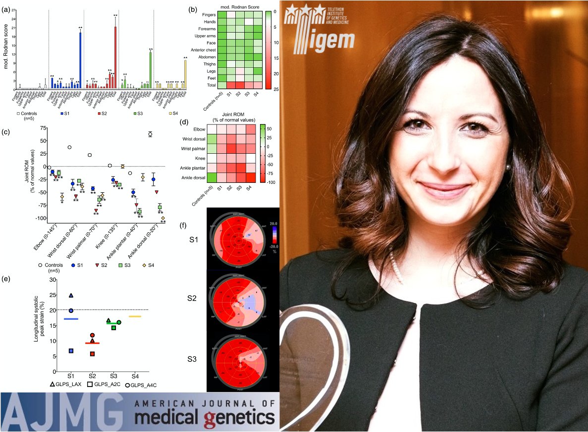 Tigem_Telethon's tweet photo. Congratulations to Gerarda Cappuccio from Brunetti’s lab for her publication on the #AJMG @WileyGenetics. She and others published a work on a pilot clinical trial with #losartan in #Myhre syndrome #TigemScience
Read more here 👇
https://t.co/WRNncvVwQx https://t.co/Uytyw4XYvS