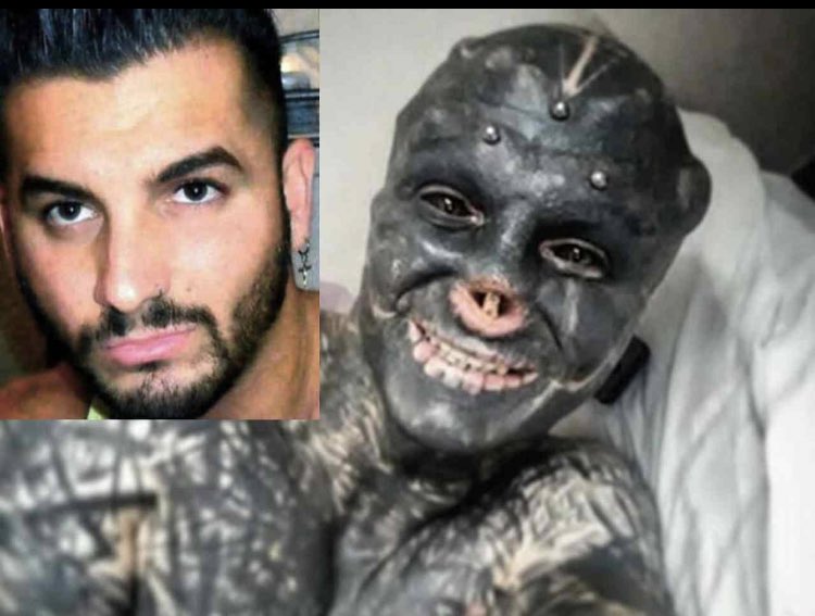 Diego01336525's tweet photo. After operazione.Che dite ?Meglio p peggio?#glowup #semprebello #singol https://t.co/epgCCXsCd3