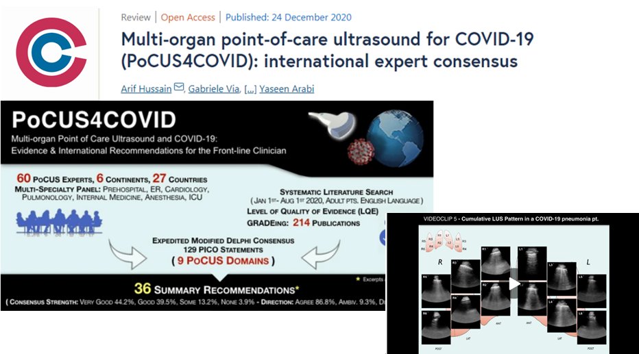 Crit_Care's tweet photo. #CritCare #OpenAccess 

Role of point-of-care #ultrasound (#PoCUS) in COVID_19 triaging: a consensus from expert panel from 27 countries and  6 continents https://t.co/x107KSdUsa

#video
#FOAMed #FOAMcc #BMC #ICU #IntensiveCare #LUS #lung #Echocardiography @jlvincen @ISICEM https://t.co/xUmIWMYxHX