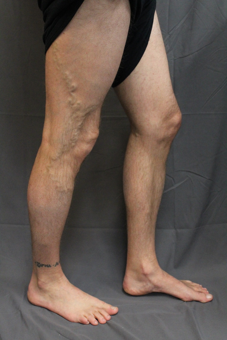 ArtemisColorado's tweet photo. New Blog Posted: Set the Goal to Resolve Vein Issues in 2021 https://t.co/jtd5R64NzA https://t.co/5Yhgt1ru39