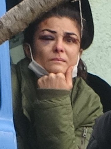 Bu halde ki bir kadını sırf bu yüzden tutuklarsanız eğer artık bu ülkede ki adaleti sadece bir duvar yazısından ibaret olduğunu  kabul edeceğiz!
#MelekİpekSerbestBırakılsın
#melekipek