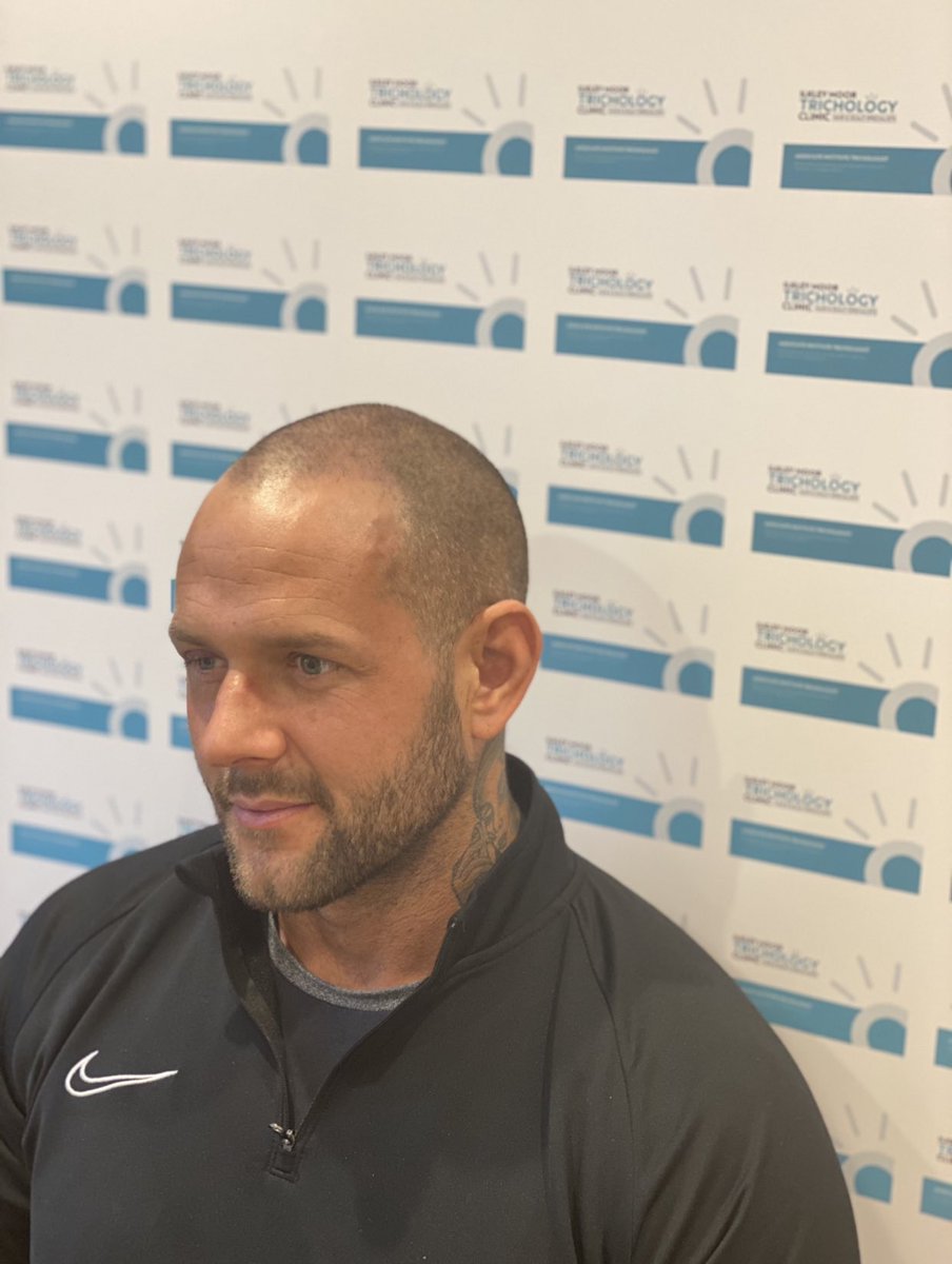 How great does our client look after starting Scalp Micropigmentation treatments with us. We don’t have a choice when it comes to hair loss.....but we do have a choice to do something about it! <a href="/AlkazrajiSara/">Ilkley Moor Trichology Clinic</a>