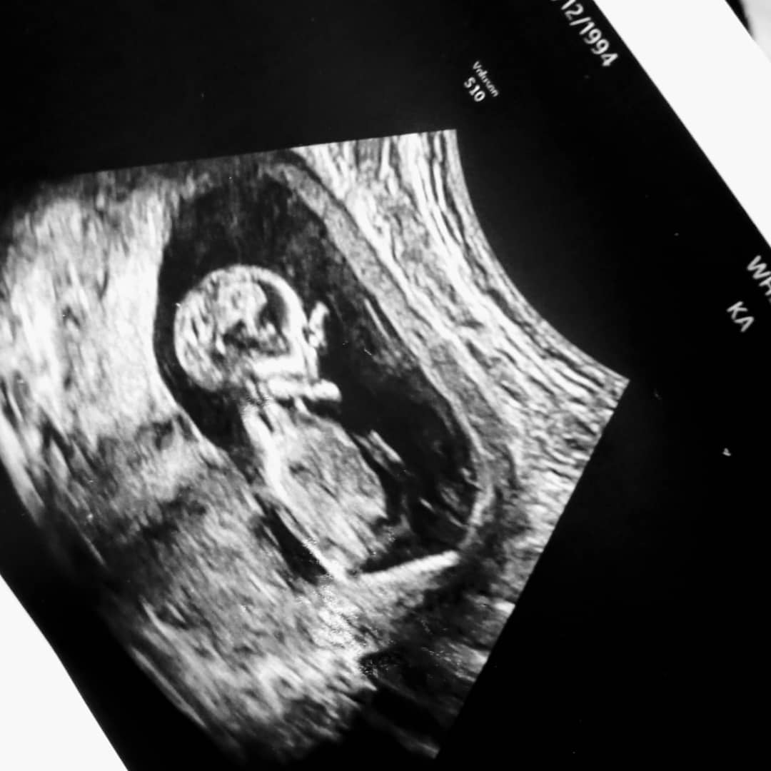 iselamarianaaa's tweet photo. We made a little runner!!👣❤😅 Making it twitter official for my 10 followers 😜 #Mommy2Be #LookAtOurPeanut 😭😍❤ https://t.co/mfJ09bLqJ8