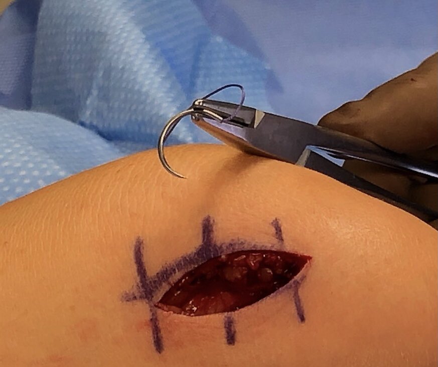 Clayton Nuelle, MD, FAAOS tweet media