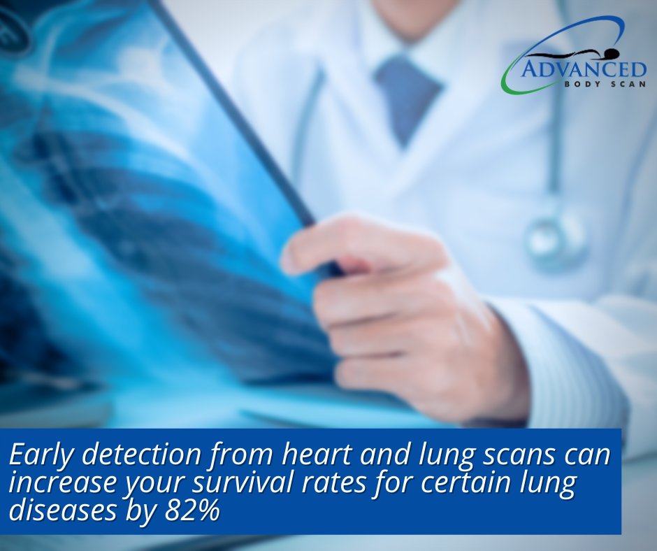 AdvBodyScanTX's tweet photo. Did you know approximately 225,000 people receive a lung cancer diagnosis each year and it is the leading cause of cancer death for men and women?
#AdvancedBodyScanOfTexas #Plano #Texas https://t.co/eZWbAdSRrk