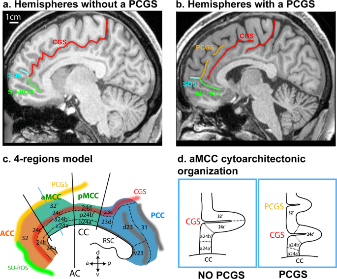 Chimpanzee histology and functional brain imaging show that the paracingulate sulcus is not human-specific dlvr.it/Rq9KsX v/ @NatureNews