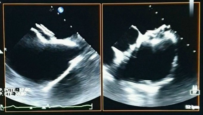 Lucas Emilio Tomatis tweet media