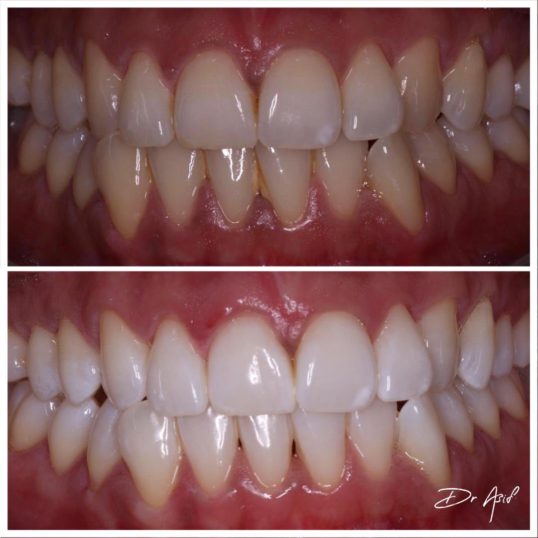 byarkdigital's tweet photo. Premium design for a high end service.
 
Dr Asif came to ark seeking a brand identity to represent his image and services offered. 
 
We designed a brand that defines elegance and class whilst reflecting Asif’s personality and service. https://t.co/OJ9C9mqA4P