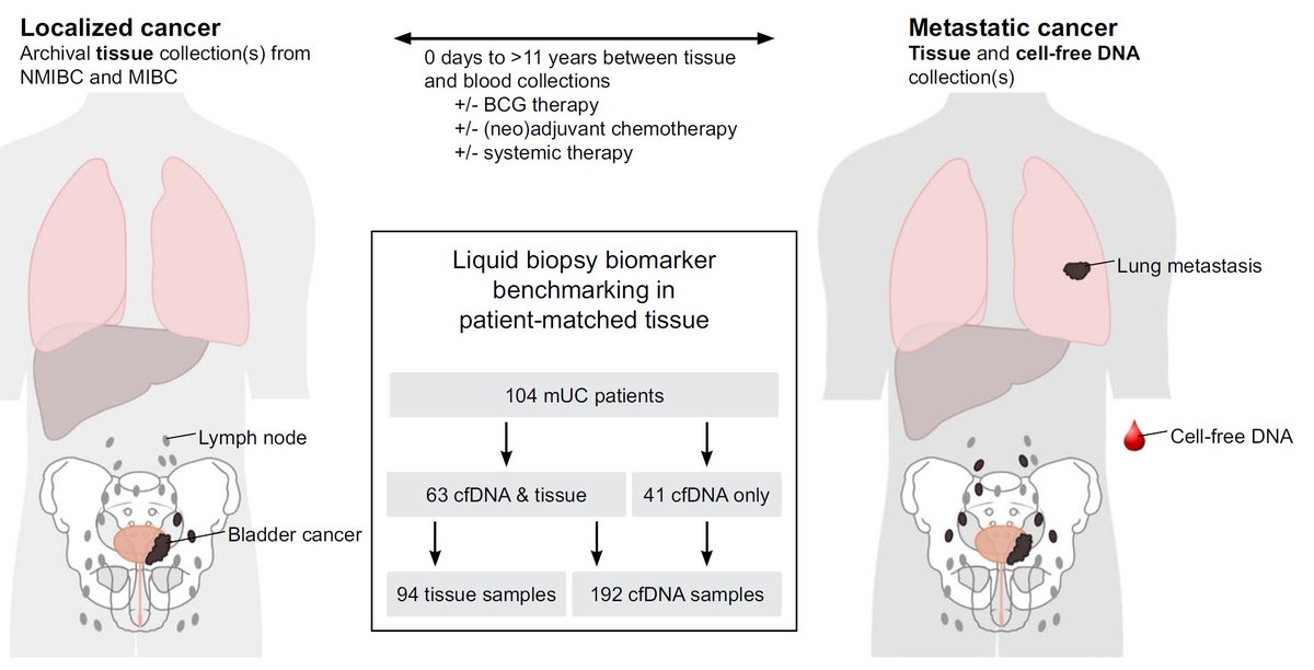 Alex Wyatt (@researchwyatt) on Twitter photo Our <a href="/NatureComms/">Nature Communications</a> paper on metastatic #BladderCancer: rdcu.be/cdgGo. We benchmark plasma ctDNA against tissue (mostly archival primary). Credit to <a href="/UBC/">University of British Columbia</a> PhD student <a href="/G_Vandekerkhove/">Gillian Vandekerkhove</a> & Dr. Eigl <a href="/BCCancer/">BC Cancer</a>, for leading a team of generous collaborators. Short thread π1/7 Our <a href="/NatureComms/">Nature Communications</a> paper on metastatic #BladderCancer: rdcu.be/cdgGo. We benchmark plasma ctDNA against tissue (mostly archival primary). Credit to <a href="/UBC/">University of British Columbia</a> PhD student <a href="/G_Vandekerkhove/">Gillian Vandekerkhove</a> & Dr. Eigl <a href="/BCCancer/">BC Cancer</a>, for leading a team of generous collaborators. Short thread π1/7