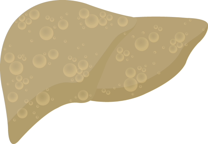 NatRevGastroHep's tweet photo. New content online: Nonalcoholic fatty liver disease: another leap forward https://t.co/xXUgc8uzOj https://t.co/eTVxE6DNhi