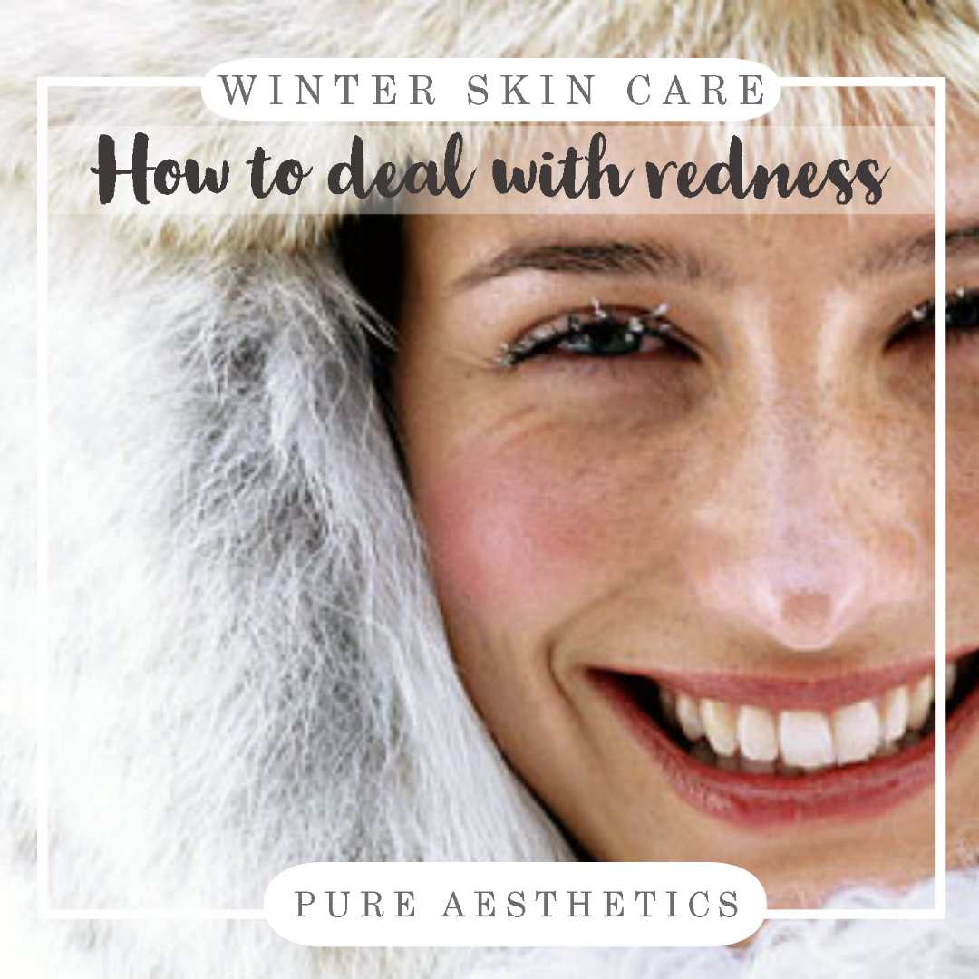 #Winter #weather can often give the #skin a rosy flush ☺️. Redness of the cheeks, nose, chin or forehead is common. #Skincare products rich in glycolic, lactic and salicylic acids will reduce inflammation, redness and congestion in the skin! 🥰 #loveyourskin #Winterskin