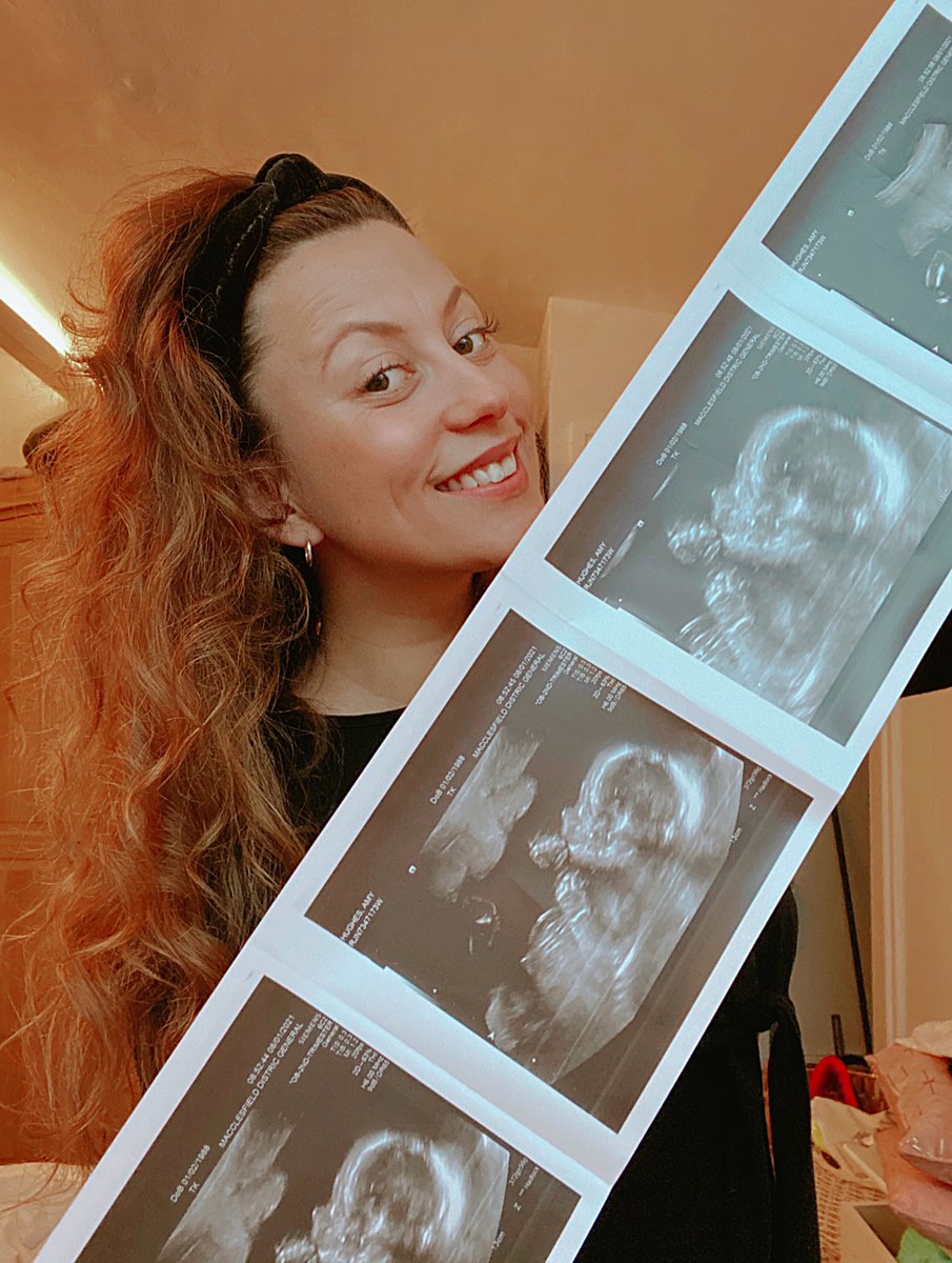 I’m obsessed! The little nose is killing me 😭💕 a little 21 week old mini me 🥰👶🏼