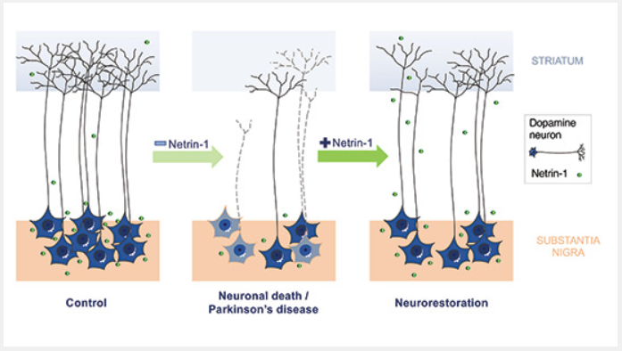 Wide collaboration study by labs of Patrick Mehlen, Keqiang Ye, Mart Saarma, and <a href="/MerjaVoutilain5/">Merja Voutilainen</a>: Role of Netrin-1 and its receptor DCC in PD finally published in EMBO embopress.org/doi/full/10.15… <a href="/MichaelJFoxOrg/">michaeljfox.org</a> <a href="/crcl/">CRCL</a> <a href="/helsinkiuni/">University of Helsinki</a> <a href="/LifeSciHelsinki/">Life Sciences University of Helsinki</a> @HiLIFE_Helsinki <a href="/BIOTECH_UH/">Institute of Biotechnology (BI)</a> #ftdk