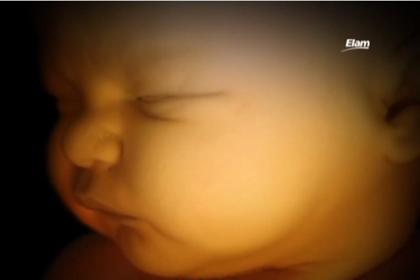 LifeNewsHQ's tweet photo. Paraguay Parliament Holds Minute of Silence for Babies Killed in Abortions https://t.co/TzvhqusLwq https://t.co/nX2uckLrdq