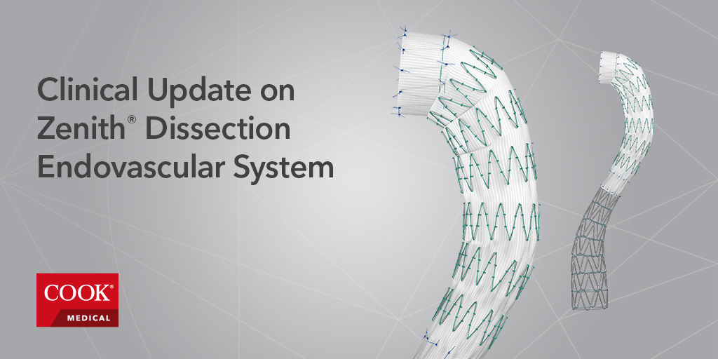 cookvascular's tweet photo. Check out our 1-year data on the Zenith Dissection Endovascular System. https://t.co/npdDRiDc8p #ZenithDissection #CookVascular #endovascular https://t.co/NWTmWqplfl