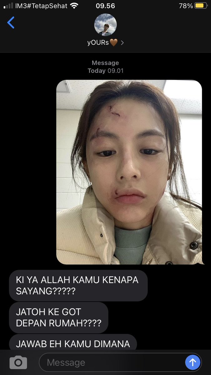 —rest. tweet media