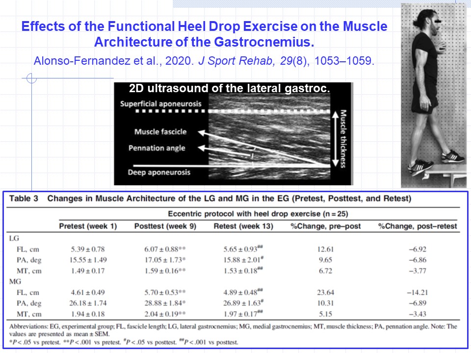 nm_mullins's tweet photo. More cool #MuscleArchitecture research.
Effects of the Functional Heel Drop Exercise on the Muscle Architecture of the Gastrocnemius
https://t.co/0wPhl3NlpC
#pennation #fasciclelength #musclethickness #eccentricloading @JSportRehab @Human_Kinetics https://t.co/2lQkiC8xAe