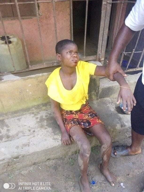 She’s a house help. Her master dropped her from the balcony of the 2nd floor of a 2 storey building 
Location is 204 Niger opposite Newday dast food Aba
Please let’s make this trend and get her justice