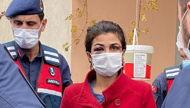 ntv's tweet photo. Kendisine işkence eden eşini öldüren Melek İpek tutuklandı https://t.co/BTkpZamKfj https://t.co/IsxjwfA6nH