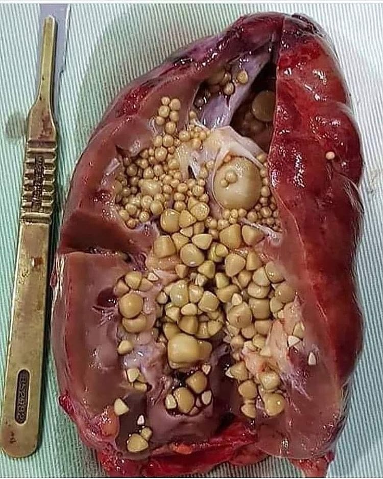 ItMedicalvid's tweet photo. Which organ do you see here? What's your diagnosis?. https://t.co/R9oQ0SStJZ