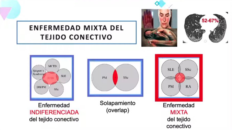 GEAS_SEMI's tweet photo. @MaykaFreire @PFanlo @fjrascon @GeasNavarra @GeasMadrid @joraltron @cpsimeon @JJRiosBlanco @bcgraciatello 🩺⚠️#Neumopatía #intersticial en #enfermedad #mixta del #tejido #conectivo (#EMTC). 
Recordar la diferencia entre #EMTC, enfermedad #indiferenciada y #síndromes de #solapamiento
Factores de riesgo para EPI: #disfagia, #Raynaud, #Ro52, #FR, entre otros
https://t.co/3hb7Psr6eH https://t.co/K3dxgZFZVL