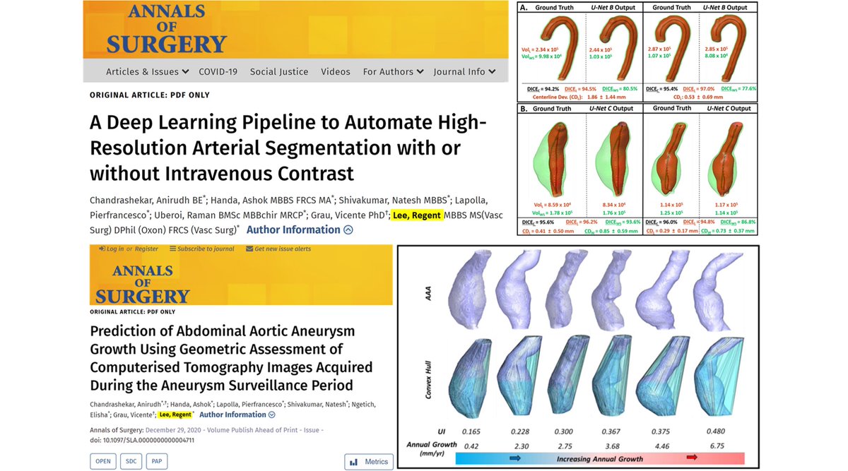 OxAAA Study (@oxaaa_study) on Twitter photo Two latest <a href="/AnnalsofSurgery/">Annals of Surgery</a> open access publications by <a href="/OxAAA_Study/">OxAAA Study</a> (1) Prediction of #abdominal_aortic_aneurysm growth using CT images journals.lww.com/annalsofsurger⦠enabled by (2) A deep learning pipeline to automate aortic/aneurysm feature extraction journals.lww.com/annalsofsurger⦠Two latest <a href="/AnnalsofSurgery/">Annals of Surgery</a> open access publications by <a href="/OxAAA_Study/">OxAAA Study</a> (1) Prediction of #abdominal_aortic_aneurysm growth using CT images journals.lww.com/annalsofsurger⦠enabled by (2) A deep learning pipeline to automate aortic/aneurysm feature extraction journals.lww.com/annalsofsurgerā¦