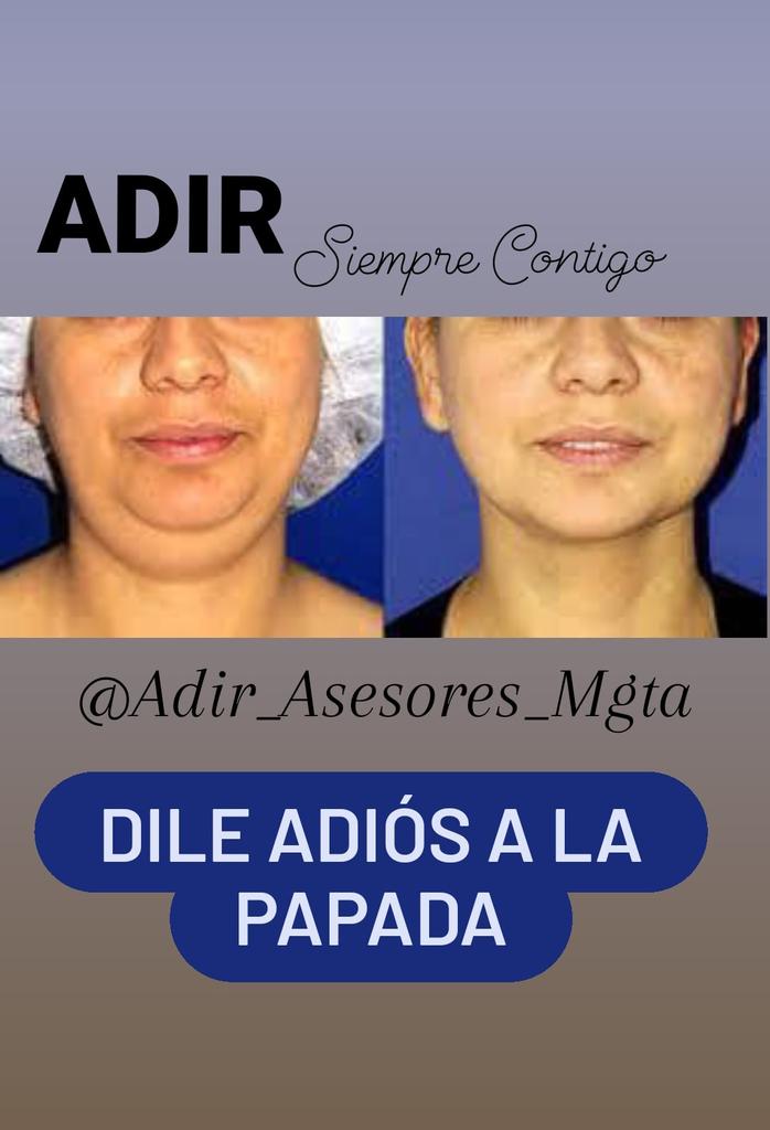 pierinamff's tweet photo. ¿Cansada de la Papada?

Aprovecha este nuevo año los mejores tratamientos de salud y belleza en el área de medicina estética y eliminala. 
Hoy Sábado tendremos  
✨ℙ𝕣𝕖𝕔𝕚𝕠 𝔼𝕤𝕡𝕖𝕔𝕚𝕒𝕝 ✨
para eliminar la *Papada* y los *Surcos Nasogenianos*.
Contactanos al 0412-0966405 https://t.co/4KkLz1Op5n