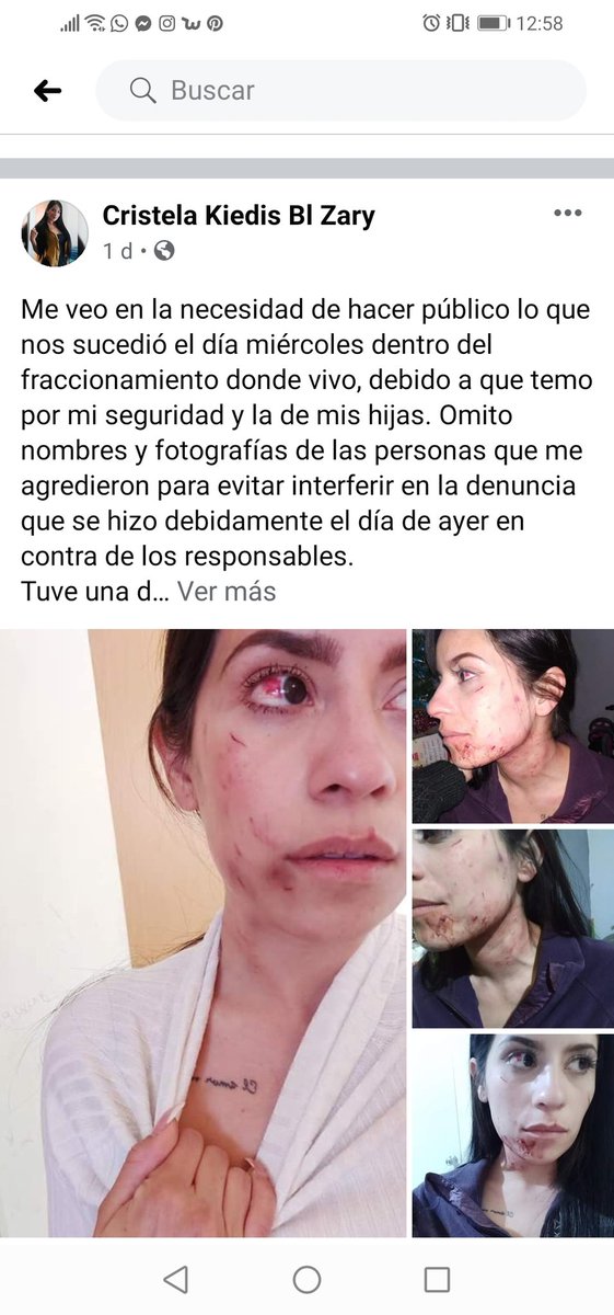 Mike_rammm's tweet photo. @mrikelme Esperemos des un posicionamiento apegado a los Derechos Humanos de la Mujer sobre el caso de la mujer agredida por una persona que dice ser tu custodio, lo mejor sería que tomes el lado correcto y pongas el ejemplo de ser un servidor público con ética y respeto por la ciudadanía https://t.co/2lk3VyKO1N