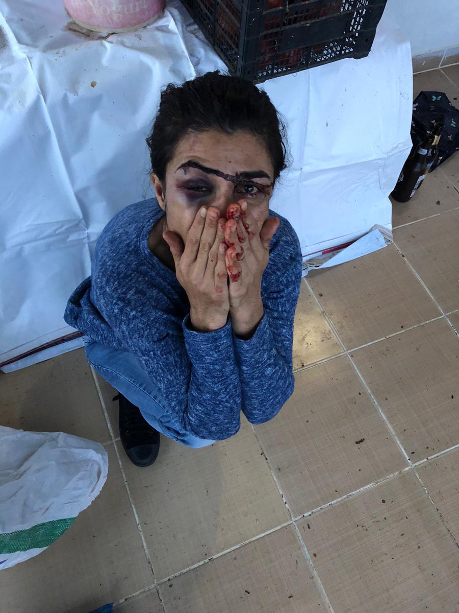 Bu şiddete engel olmak isterken, çocuklarını korumaya çalışırken sonuç ölüm oldu
#MelekİpekDerhalSerbestBırakılsın