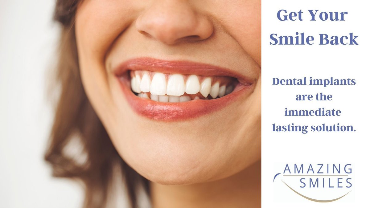 JandaliDMD's tweet photo. Get Your Smile Back
Dental implants are the immediate lasting solution.

#dentalimplants #dentistry #DigitalDentistry #SmileDesign #SameDayTeeth #dentist #dental #smile #teeth #implants #oralsurgery #dentalclinic #dentalcare #oralhealth #smilemakeover #implantdentistry https://t.co/SEU8qZjyjF