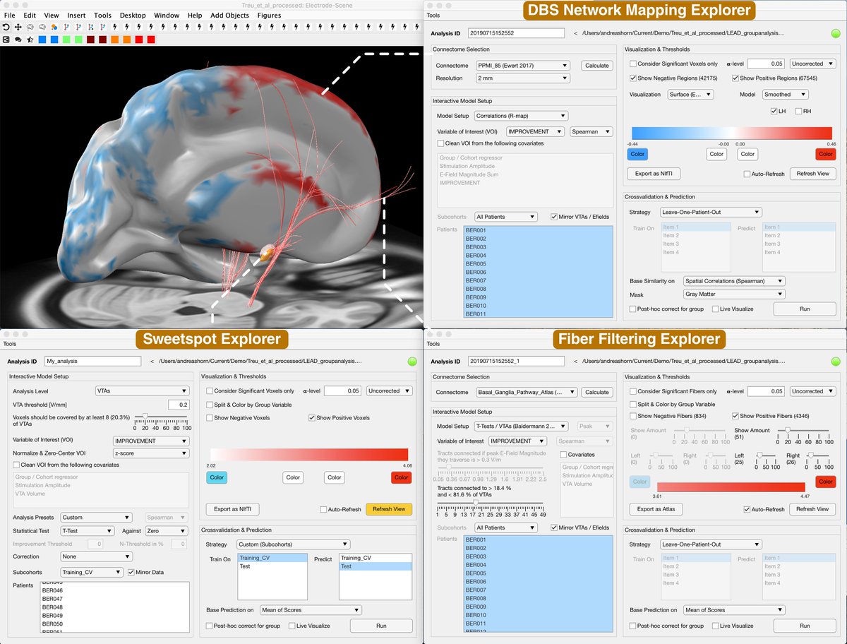 Drumroll...! 🥁🥁🥁

Lead-DBS v2.5 is finally online!

Tons of updates – read all about it in our newsletter that we are currently sending out to &gt;4.2k colleagues, world-wide:

lead-dbs.org/?na=view&id=24