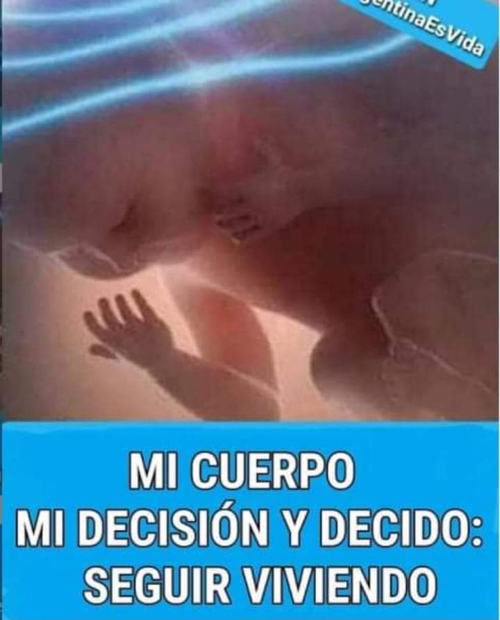 Pabliyvos's tweet photo. #AbortoEsInconstitucional #AbortoEsInconstitucional #AbortoEsInconstitucional #AbortoEsInconstitucional #AbortoEsInconstitucional #AbortoEsInconstitucional #AbortoEsInconstitucional #AbortoEsInconstitucional #AbortoEsInconstitucional #AbortoEsInconstitucional https://t.co/eUtYMTQVcv