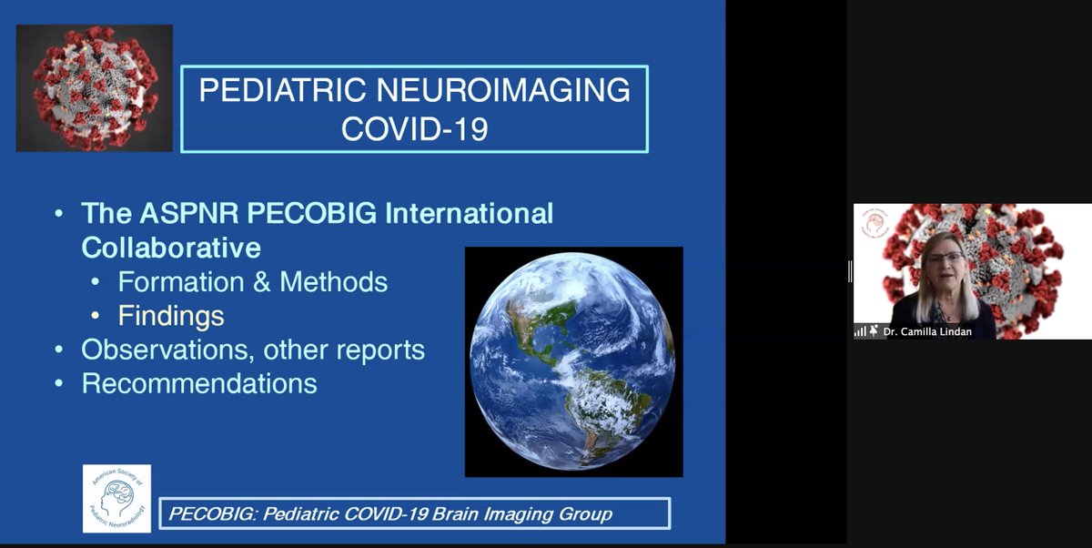 JudyGadde's tweet photo. #ASPNR21 Fantastic pediatric #COVID19 update and discussion from Drs. Dipak Ram, @Larry_Kociolek, and Camilla Lindan! @LurieChildrens @UCSFimaging #PediNeuroRad @The_ASPNR https://t.co/RENjVGo9sl