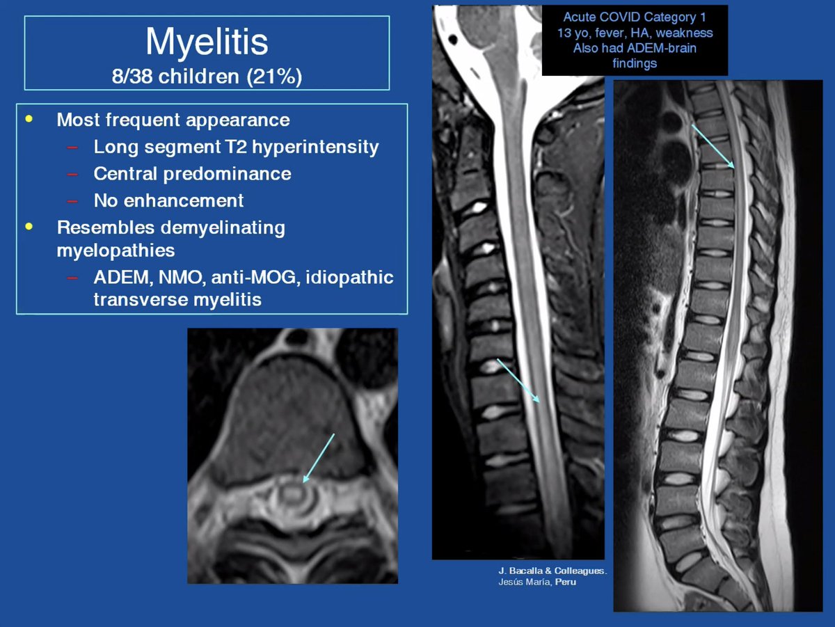JudyGadde's tweet photo. #ASPNR21 Fantastic pediatric #COVID19 update and discussion from Drs. Dipak Ram, @Larry_Kociolek, and Camilla Lindan! @LurieChildrens @UCSFimaging #PediNeuroRad @The_ASPNR https://t.co/RENjVGo9sl