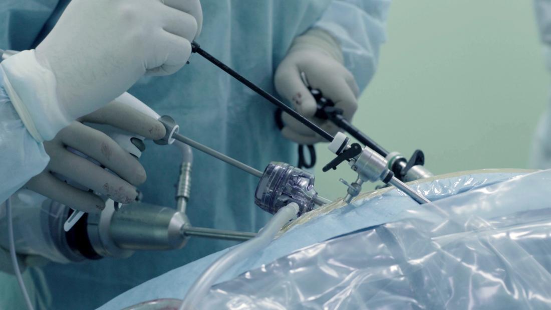 HubSurgery's tweet photo. Todo tipo de cirugía debe de seguir los procedimientos más rigurosos posibles para garantizar el beneficio del paciente.
Este es uno de los fundamentos de la cirugía mínimamente invasiva.
La minilaparoscopía (#MiniLap) es una forma de cumplir con esta máxima. #CirugíaSegura https://t.co/WSlOzjxesE