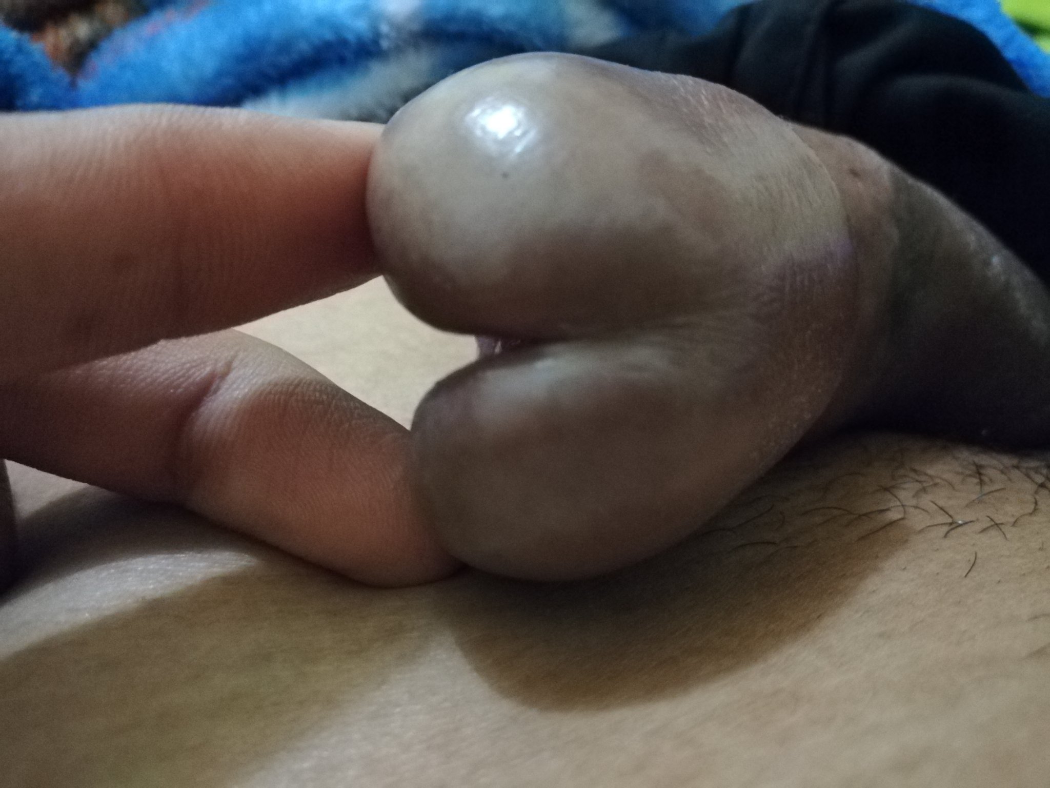 Yuuuuk #princealbertpiercing #papiercing #princealbert #piercing #piercedcock #PA #dick #pierceddick #genitalpiercing #teamPA #gauge #00g #bigdick #subincision #splitcock #papiercing https://t.co/H8EADB33d2