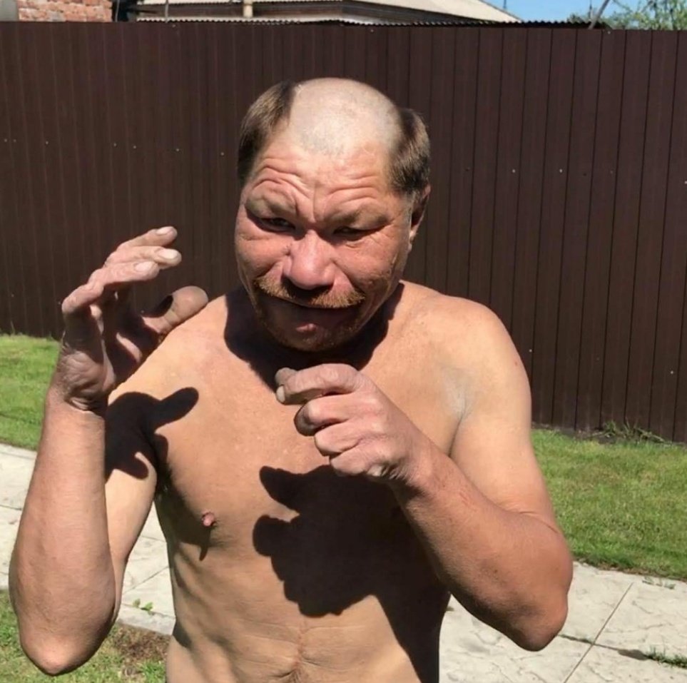 MMAassault1's tweet photo. Herb: Watch the nipples. They catch him in the eye again and I'm taking a point https://t.co/UDBAqQu8rV
