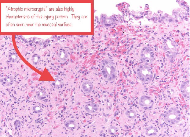 Second image from:  https://pubmed.ncbi.nlm.nih.gov/29177895/&nbsp;
