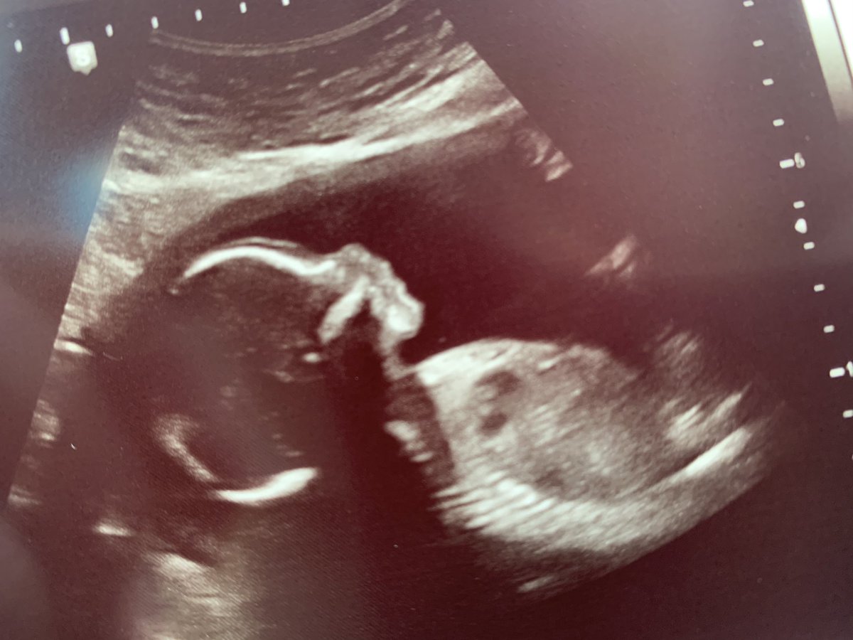 NickLutsko's tweet photo. Seems like the only appropriate way to announce that the wife and I are expecting on here https://t.co/CJ3lVajGjX